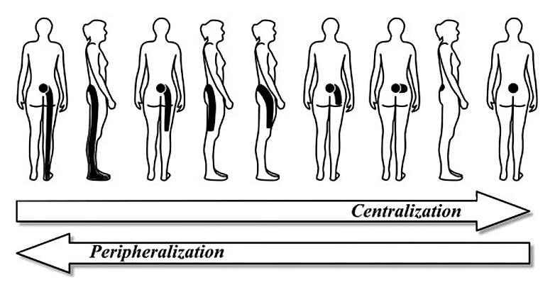Lumbar Spine Centralization